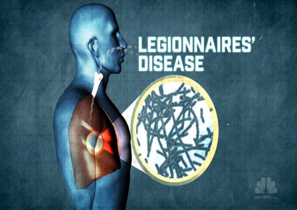 Legionnaires Disease