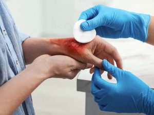 Wound care management training